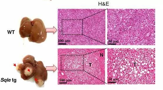 sqle过表达小鼠与正常小鼠肝脏对比我们的研究结果提供证据表明sqle在