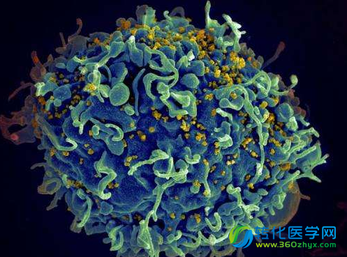 HIV或许并不会引发AIDS 罪魁祸首是机体自身的免疫细胞