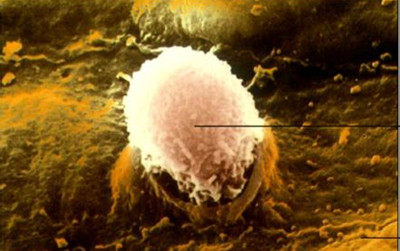 Stem Cells：科学家首次将人类皮肤细胞成功转化为白细胞