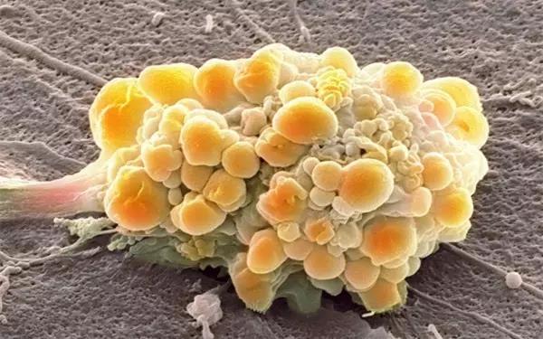 Nature发布癌症转移研究重大突破：脱离肿瘤只需几秒
