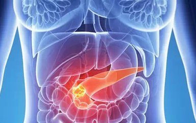 研究人员发现外泌体与胰腺癌之间的神秘关系