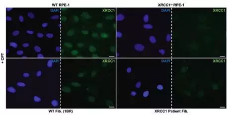 Nature：XRCC1基因突变导致小脑运动失调