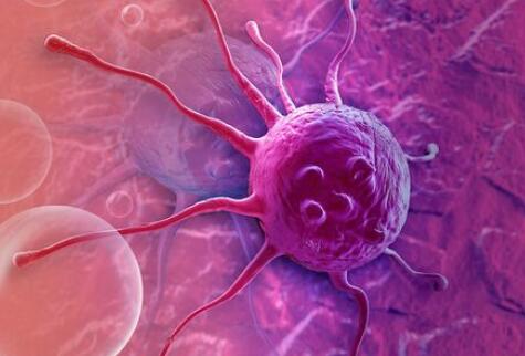 【Nature子刊】香港中文大学再发文：揭示“癌细胞”获得“铁死亡”抗性的新途径