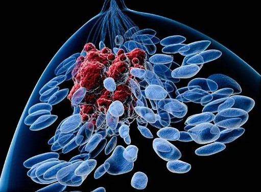 迎难而上！“复旦肿瘤”邵志敏团队揭示驱动“最毒”乳腺癌进展和耐药性新方法