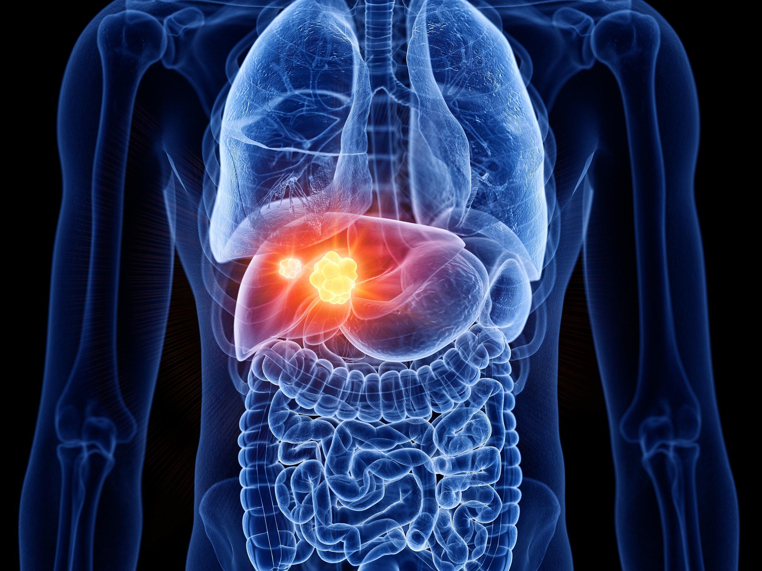 新线索！海军军医大学发现肝细胞癌性别差异机制