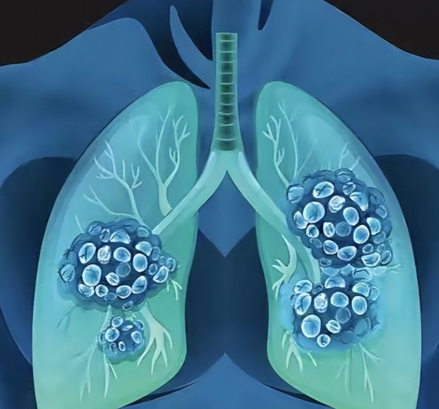 “宝藏”资源！复旦大学陈海泉团队：驱动肺癌发生发展的主要分子事件