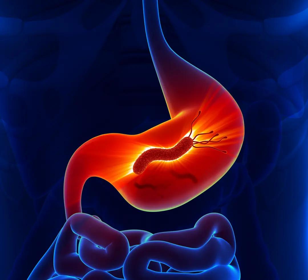 再取进展！苏州大学发文揭示抑制胃癌增殖和转移新机制