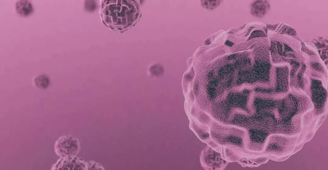 首次！香港大学最新研究：发现“最毒乳腺癌”预后指标和潜在治疗靶点