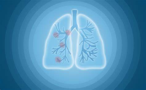 【Nature子刊】中国医学科学院北京协和医学院王冬来团队：揭示调节肺癌转移新机制