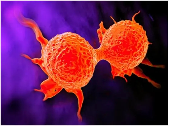 再取进展！南京医科大学何帮顺/王书奎团队揭示乳腺癌进展新机制及治疗新靶点