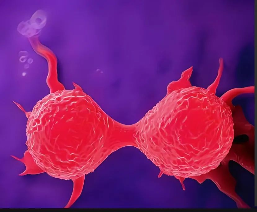 乘胜追击！中山大学发文：揭示乳腺癌靶向治疗新策略