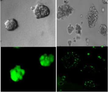 PLoS ONE：科学家发现细菌的信号分子或可有效杀灭胰腺癌细胞