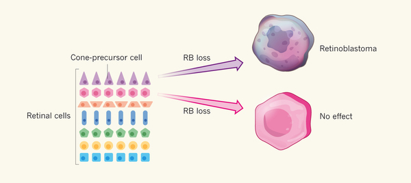 NATURE:视网膜母细胞瘤起源揭秘