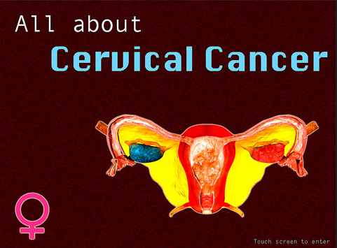 BJGP：年轻女性或经常忽视宫颈癌筛查的重要性