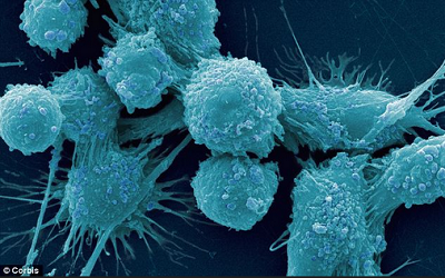 重新“布局”细胞代谢减缓癌症的发展