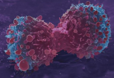 新型化合物结合放疗可保护正常细胞且靶向杀灭癌细胞