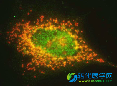 Nat Med：科学家揭示外套细胞淋巴瘤发病的分子机理