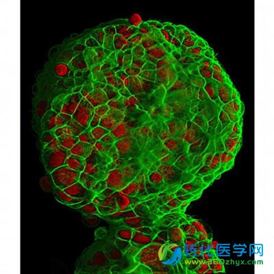 Cell：研究人员建立胰腺癌细胞三维培养模型