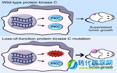 Cell：颠覆数十年癌症教条，PKC竟是肿瘤抑制因子