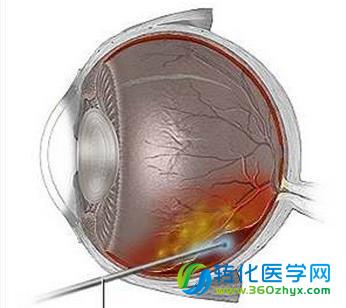 人类胚胎干细胞首次培养出视网膜 盲人复明有望