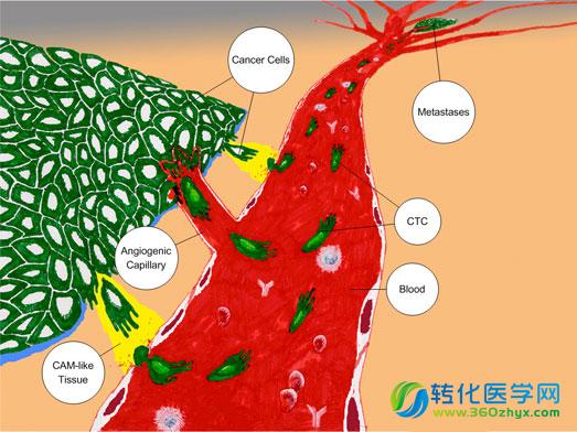 是什么让癌细胞扩散？