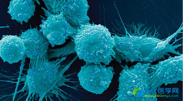 Cancer Cell：科学家发现促进癌细胞死亡的特殊分子化合物