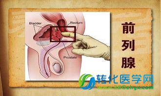 Nature子刊：新的前列腺癌致病基因