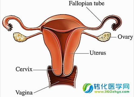 大型GWAS研究解析卵巢癌起源