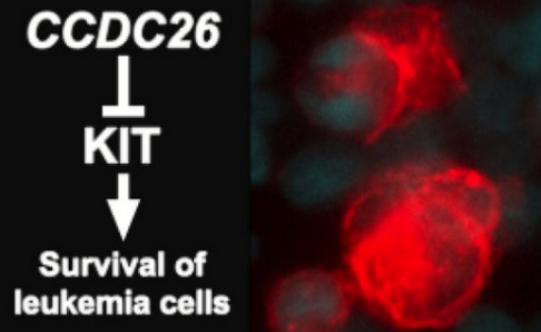 MolCancer：科学家发现治疗急性髓性白血病的新靶点