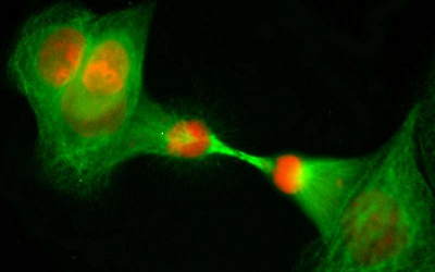 Cell：重大突破！科学家发现天冬氨酸或是细胞增殖的限速器