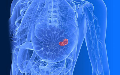 BreastCancerRes：乳腺癌新型生物标志物及治疗靶点