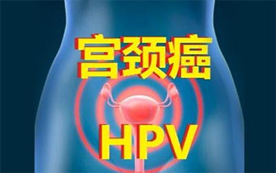 发现中国人乳头瘤病毒传播特征