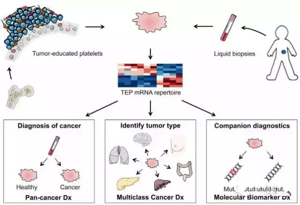 揭示肿瘤诊断新方法，基于血小板的RNA测序
