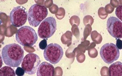 Science医学：让癌细胞无处遁形的注射剂