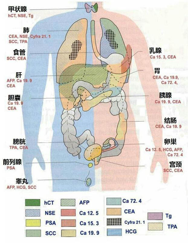 超实用的肿瘤标志物图解