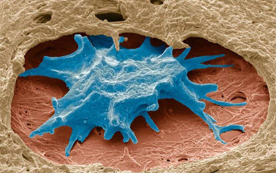 PNAS：根除癌症新举措——扼杀于摇篮中