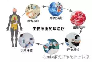 肿瘤细胞治疗“四大类”：CIK细胞、DC细胞、NK细胞、CTL/TCR-T/CAR-T细胞