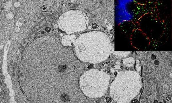 microRNA调节眼睛干细胞功能的分子机制