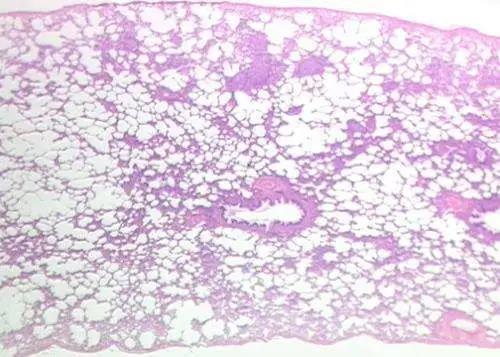 【Science Advances】持久而低毒性的抗菌肽可抵抗“超级细菌”肺部感染