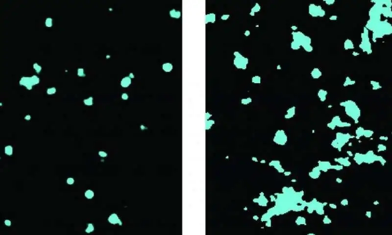 【PNAS】麻醉剂对意识的影响有结论了！一个世纪以来的科学争论落下了帷幕