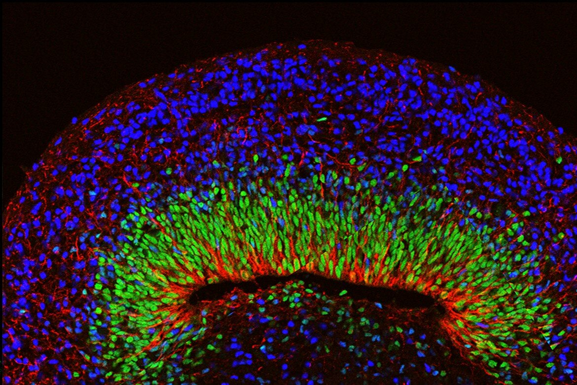 【Nature子刊】利用干细胞诱导生成的3D大脑类器官，可精确复制人类大脑