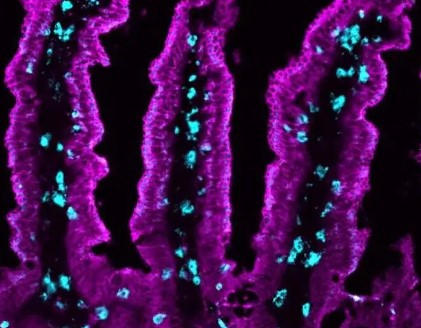 Nature重磅！加州大学等研究揭秘T细胞征服肿瘤的机制 增强免疫防御