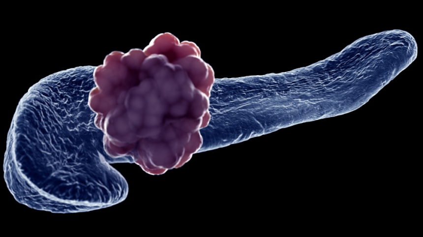 【STTT】南京大学杜娟/刘宝瑞团队发文揭示转移性胰腺癌创新治疗方案