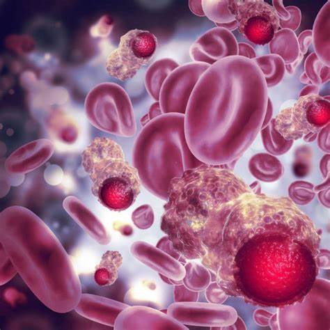 【Nature子刊】深圳大学付利团队揭示结直肠癌新发现：胆固醇引发免疫抑制，影响记忆T细胞活性