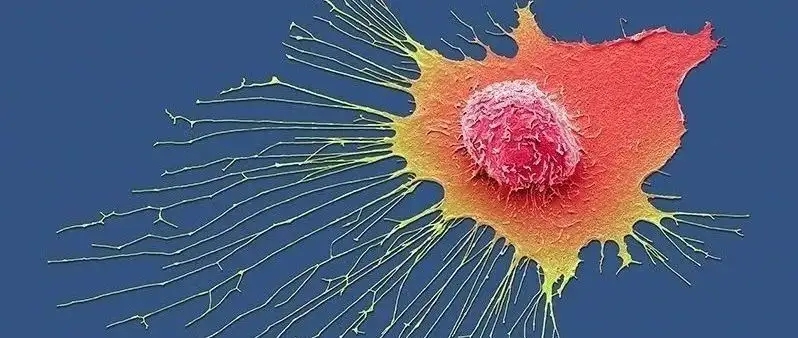 抑制肿瘤生长和复发！中山大学苏中振团队：治疗“最毒乳腺癌”的多功能纳米药物